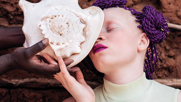 Eine Frau mit Albinismus berührt mit ihrem Gesicht eine weiße Muschel, die ihr von einer schwarzen Hand gereicht wird